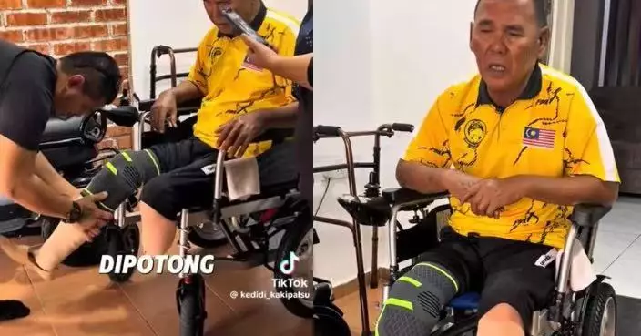 長期飲汽水加煉乳 大馬男糖尿病惡化引發併發症被迫截肢 衛生署2控糖建議