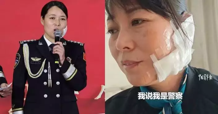 休假陪仔行街遇持刀惡漢 河南女警徒手奪刀制止 面頸被割傷縫30針