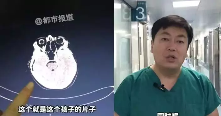 近40度高溫池浸泡20分鐘 鄭州13歲男童突感不適送院遭揭腦出血 醫生籲勿超10分鐘