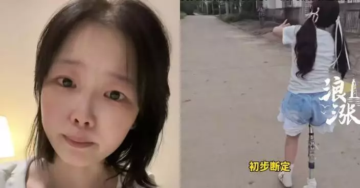 患骨肉瘤遭父母離棄獨自抗癌5年 安徽女網紅截肢後病情再惡化仍樂觀面對