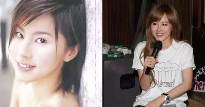 被屈整容20年　傅穎長文怒斥：寫到我天天整、年年整