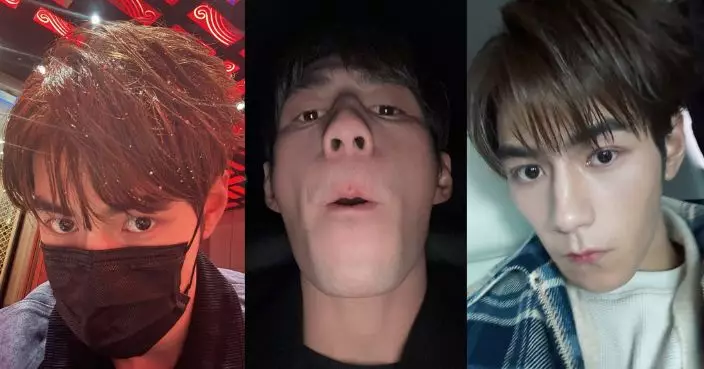 Jeffrey魏浚笙公開「黑圖」自嘲 低炒自拍檢查鼻哥窿