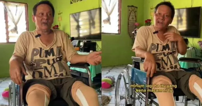 義肢商TikTok分享血淚案例！大馬男因汽水成癮截肢 親身勸世：年輕健康也別輕忽