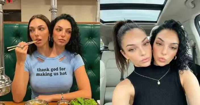 曬「共用身體日常」狂吸28萬粉 國外連體姊妹網紅遭專家揭AI生成