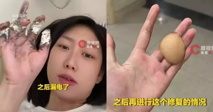 未斷電操作釀意外 吉林女生夜市擺攤觸電手指受創需腹部「借肉」修復