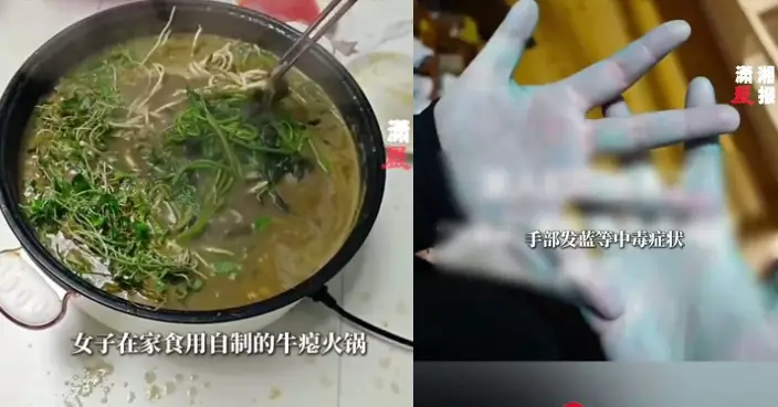 家中食自製牛癟火鍋加不明蔬菜中毒 成都一家4口暈嘔雙手「變藍」被送院