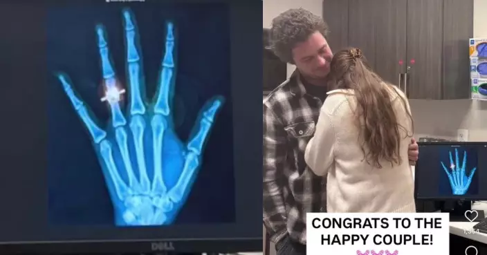 X光影像顯示「無名指戴戒指」 美國女得知男友聯手醫護浪漫求婚驚喜不已