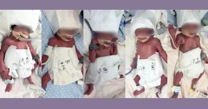 機率僅六千萬分之一 新疆24歲產婦自然受孕誕下1男4女5胞胎