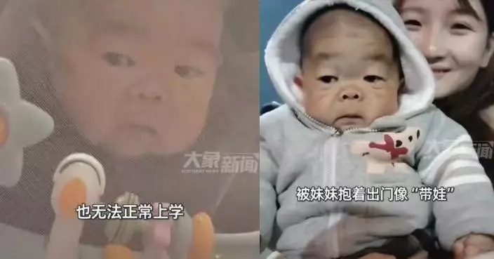 患先心病缺生長激素身高僅60CM  湖南25歲男身心如幼兒需20歲妹長年照顧