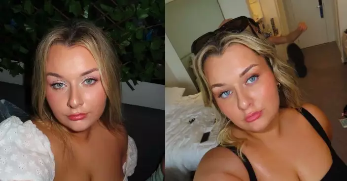 背部受傷無法健身照樣瘦 澳洲女把動物園當健走步道1年狂減20KG