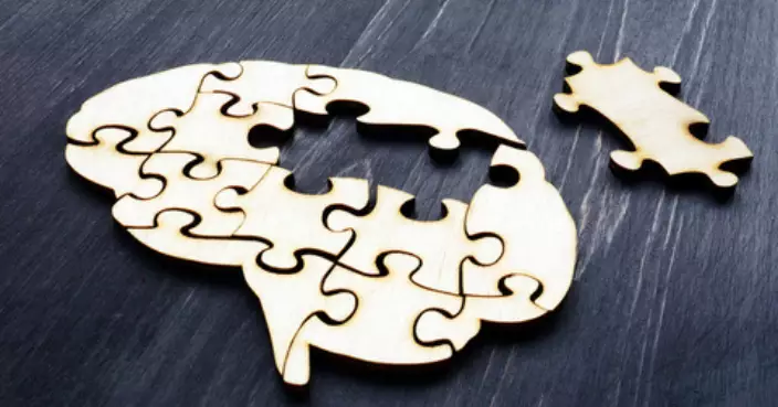 補充劑混搭恐傷腦　美神經科醫生警告高風險組合！