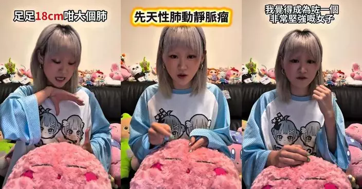 楊安妮患罕見病「先天性肺動靜脈瘤」 切18cm肺部保命 親述康復痛苦過程