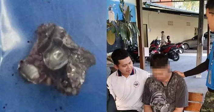 中國女遊客泰國射擊場體驗後拍照 遭流彈擊中臉頰卡9mm子彈