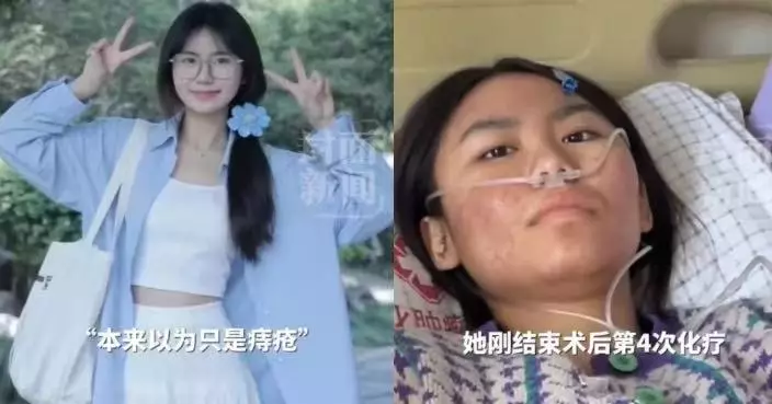 考上研究所同年確診大腸癌晚期 雲南女與患乳癌母齊齊抗癌靠直播籌醫療費