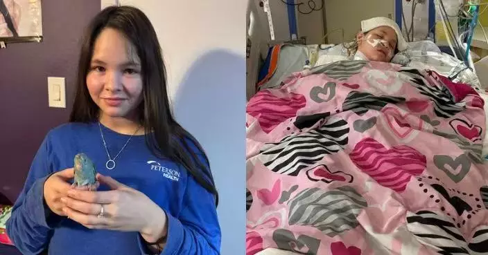 染流感病情急轉直下 美13歲少女併發肺炎鏈球菌感染致器官衰竭被迫截去3肢