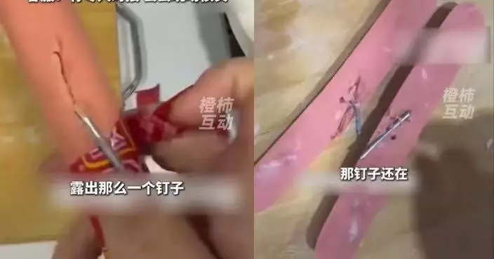 雙匯火腿腸現異常硬物 山西男切開驚見內嵌兩根「鋼釘」 商家上門排查賠償