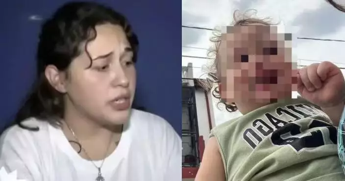 疑誤吞母親掉落美甲貼片堵塞呼吸道 阿根廷1歲男童送院途中窒息不治