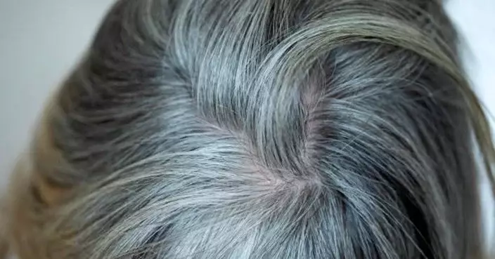 長白髮或因營養不足並非衰老！營養師教補6大營養素助改善