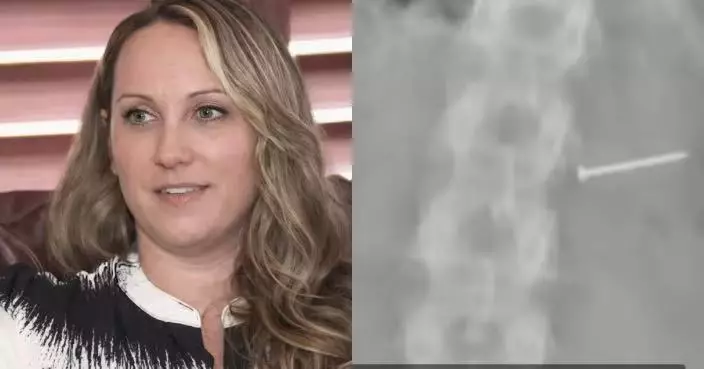 雪糕混入金屬釘及碎片 美國女誤當果仁吞落肚身體受創失生育能力獲賠1.1億