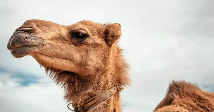 贏比賽不擇手段！阿曼駱駝選美爆「整形潮」　獸醫警告：或影響駱駝健康