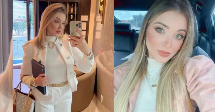 貪靚同日連做3項整形手術 巴西31歲女數日後突倒斃家中浴室