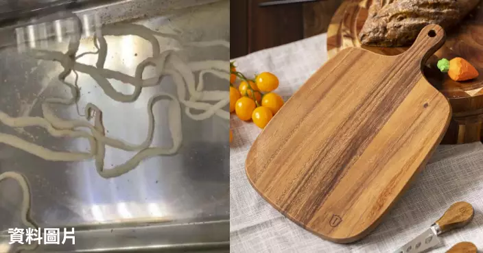 深圳女子體內排出3米寄生蟲　醫生：砧板生熟混用引發感染