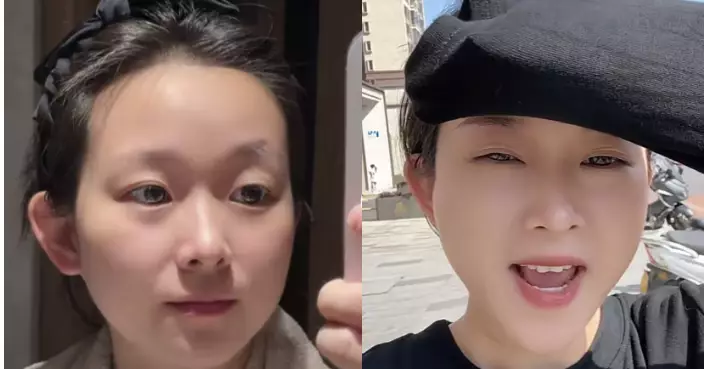 天生童顏超困擾 33歲南京女屢遭誤認小學生 網友：羨慕到不行