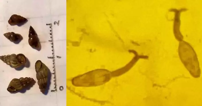 4月至10月吸血蟲感染高發期 10秒鑽皮膚 「淡水迷你釘螺」是致命傳染源