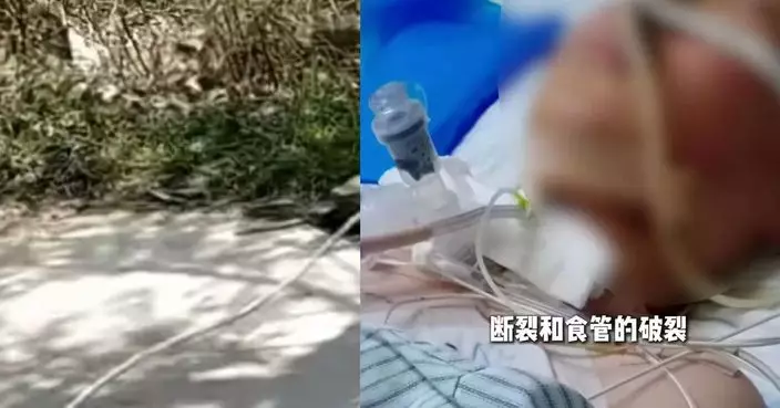 河南翁私裝繩索防粟米被破壞 13歲少年騎單車遭「割喉」一段氣管仍未尋回