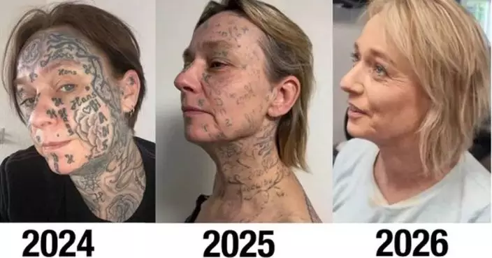 男友購平價刺青機迫紋身 荷蘭女全身九成250處遭刻名「標記」