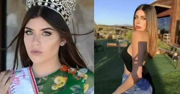 墨西哥選美冠軍頭部中彈倒斃公寓 丈夫稱婆媳糾紛延遲1日報案疑點重重