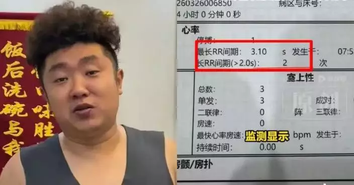 嘴唇發紫被粉絲勸就醫 內地32歲男網紅檢查遭揭心臟停搏兩次險出事