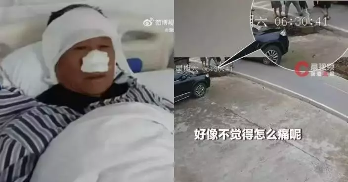 街頭目擊女子遭襲擊 湖南7旬翁挺身救人遭咬斷鼻子仍忍痛制服歹徒