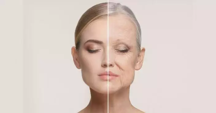 3D研究分析面部衰老軌跡 女性更年期後老化明顯加速