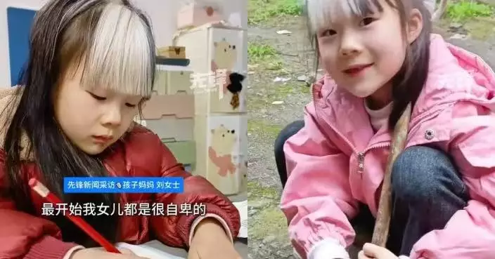 湖南7歲女童患斑駁病長白色劉海 曾因異樣目光不敢外出  母盼減少言語傷害