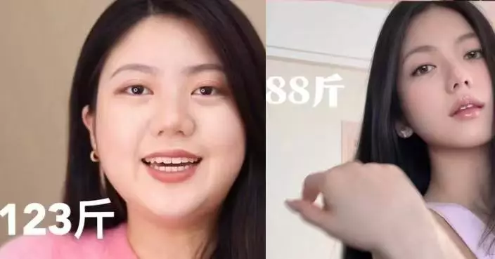 靠規律飲食與重訓 小紅書博主自爆成功減重18公斤3年未反彈 曬驚人對比照