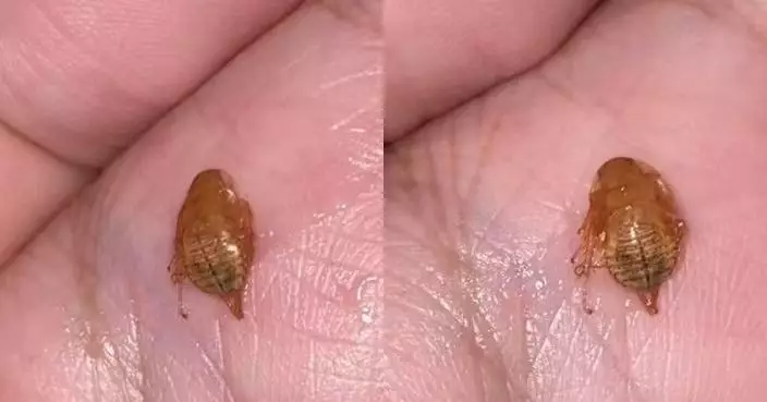 泰男喉嚨不適咳出不明昆蟲女友po上網求辨認 網驚：還不如不知道