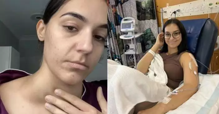 皮膚痕癢求醫被告知「保濕即可」 女子自行查資料揭淋巴癌已擴散至脾臟需化療