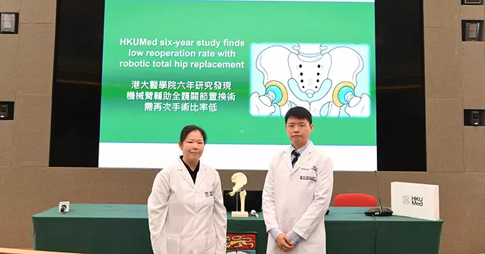 港大醫學院：機械臂輔助全髖關節置換手術顯著提升手術精準度  有效降低「翻做手術」比率