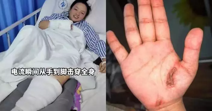 邊充電邊滑手機 貴州女意外觸電「電流貫穿全身」麻痺入ICU搶救