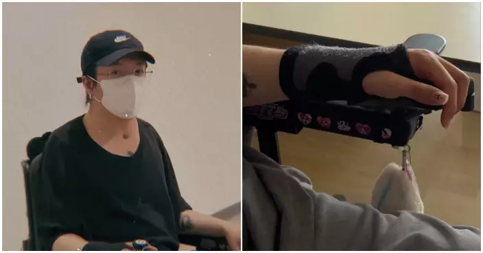 阿Mo李啟言左手操控輪椅技巧驚人 康復路不忘幽默晒指甲貼紙collection