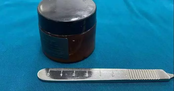 一時好奇塞乳霜罐入肛門險致腸穿窿 越南漢劇痛難忍求醫免開腹取出