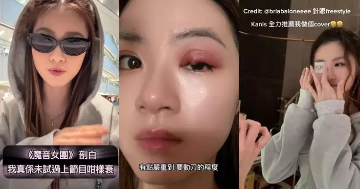 魔音女團｜王汛文眼挑針變獨眼龍 照跳無誤助QUEEN BEE晉級