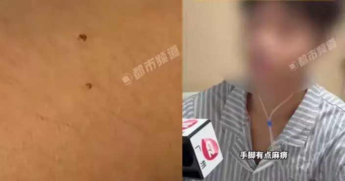 校園草叢遭銀環蛇咬傷 廣州14歲男生延誤近9小時求醫 醫生：再遲2小時恐沒命