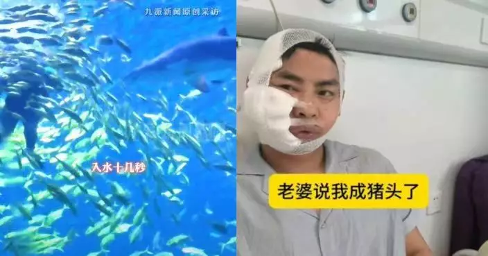 小童都可參加項目 湖南漢海洋館潛水遭3米沙虎鯊咬傷面部留7齒印