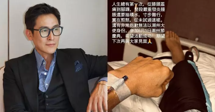 視帝馬德鐘緊急入院！右腳腫脹抽積水 直呼人生最痛