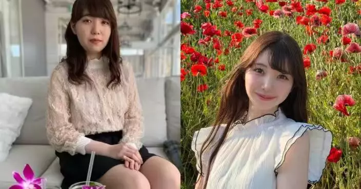 27歲逆齡後生過17歲？日女護理師公開10年前後對比照大方承認整形