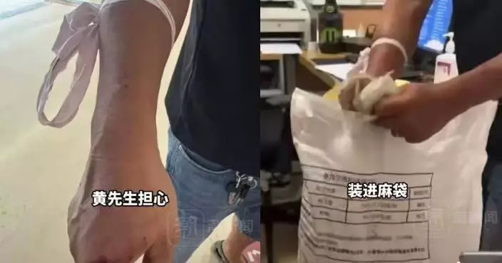 驅蛇反遭咬傷右手 雲南漢徒手捉1米長眼鏡蛇裝麻袋帶往醫院求診