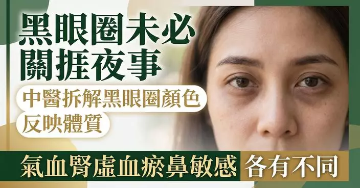 黑眼圈未必是捱夜所致 中醫：不同顏色與狀態或反映不同體質