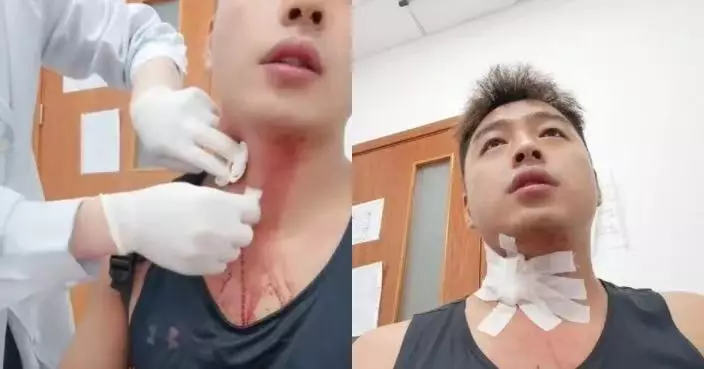 遭蚊叮後抓破頸部血管 上海男流血近50分鐘衣服車廂全染紅被送院治理